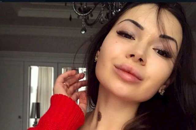 "Делают дебилами": психотерапевт назвала главных виновников ДТП с Зайцевой