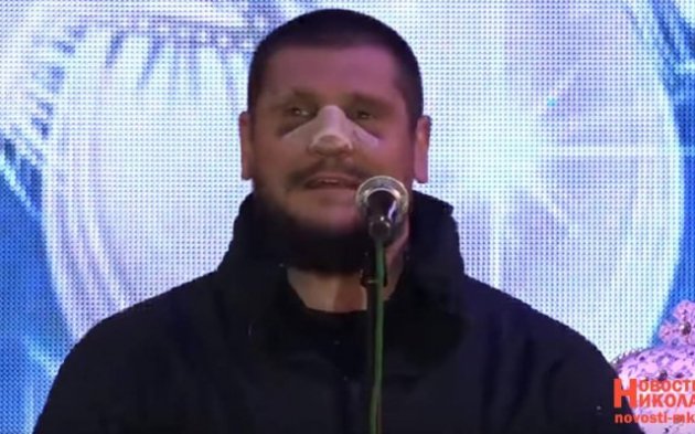 У Савченко лицо в синяках и перебит нос