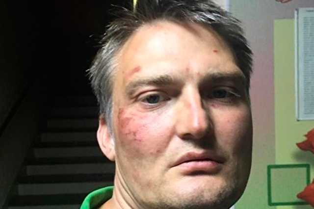 На сочинского адвоката, избитого при задержании, возбуждено дело о насилии над силовиками