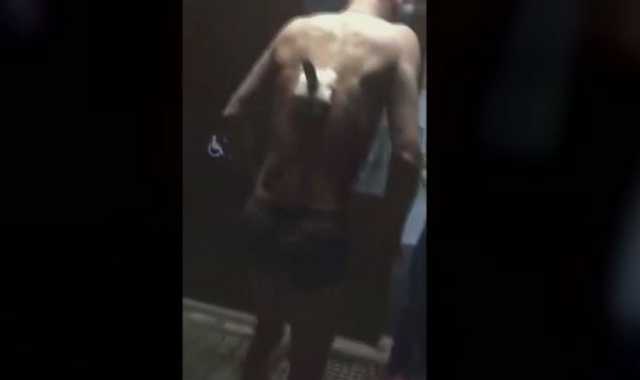 В Татарстане пациент с ножом в спине вышел на перекур