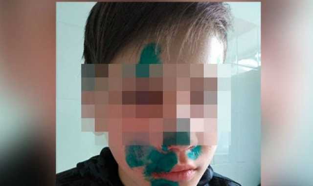 На Алтае учитель разбил непослушному школьнику лицо