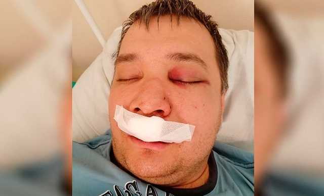 В Новосибирске подростки жестоко избили мужчину около ТРК «Континент»