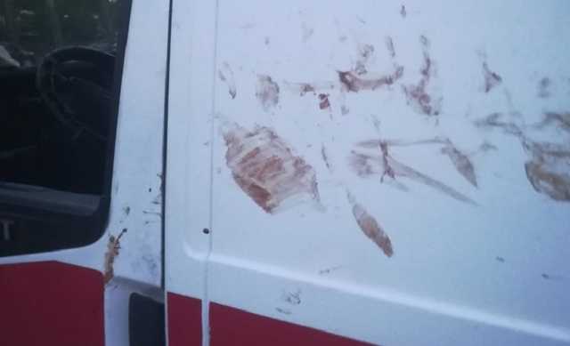 «Схватил за волосы и начал душить»: житель Челябинска напал на врача «скорой»