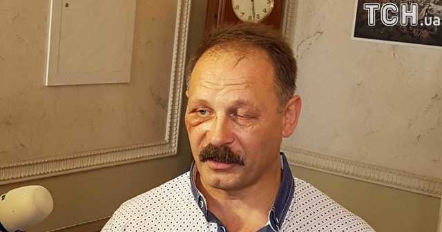 Экс-нардеп Барна подался в инвалиды
