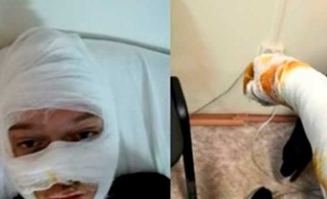 Обгоревших в полицейском УАЗике подростков обвинили в поджоге