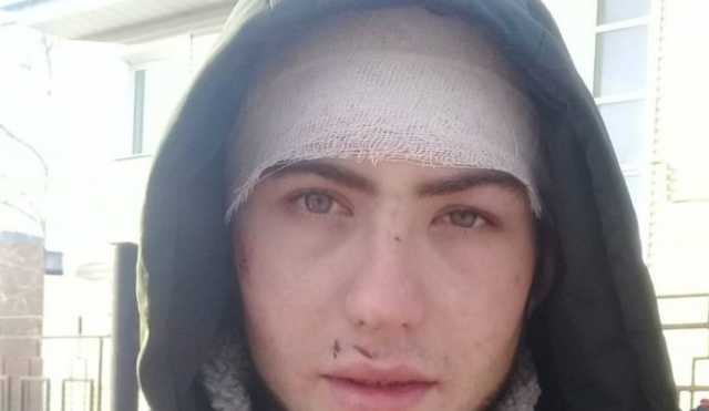 Сибирский полицейский сломал себе ногу при избиении задержанного