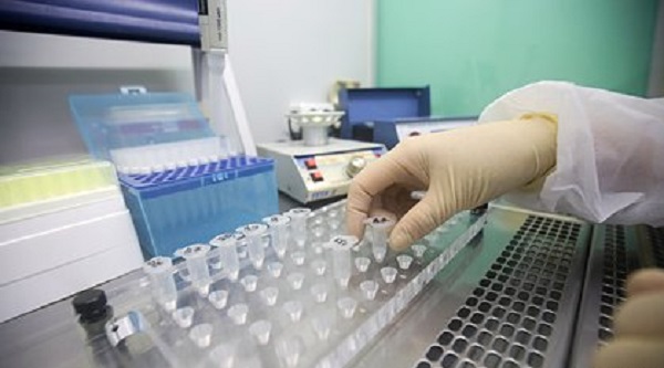 Россияне без симптомов ОРВИ смогут провериться на коронавирус