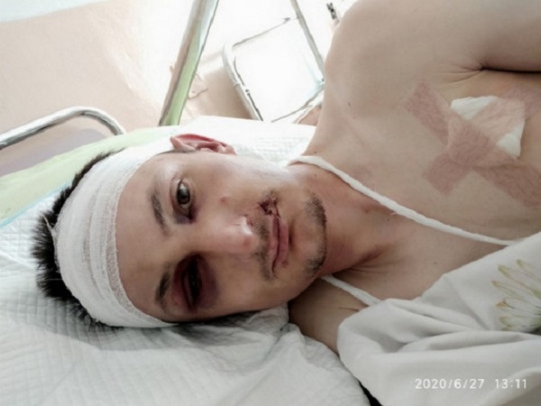 Выдавливали глаза и стреляли в голову: на Черкасчине судят злоумышленников, зверски пытавших бизнесмена