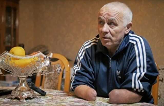 В Нальчике инвалид без кистей обеих рук осужден за применение насилия к полицейскому