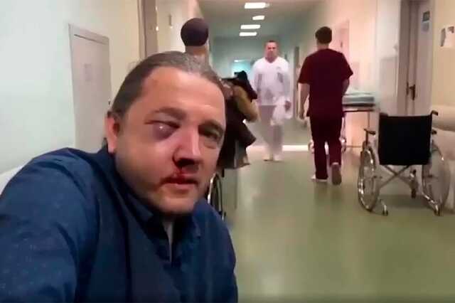 После избиения экс-депутата Госдумы возбудили уголовное дело