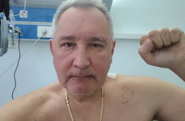 Рогозин поделился первым снимком после ранения