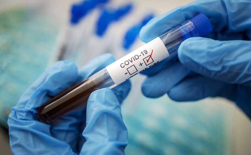 В Роспотребнадзоре оценили вероятность завершения пандемии COVID-19
