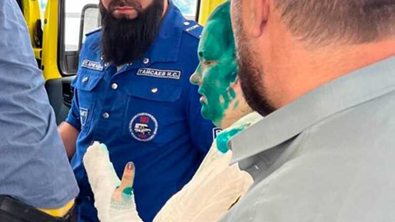 Минцифры пообещало оказать помощь пострадавшей журналистке Милашиной