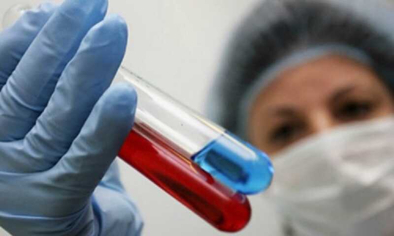 Россиянин специально заражал своих девушек ВИЧ-инфекцией