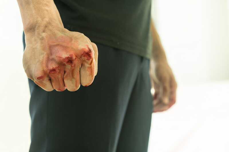 В Берлине школьники избили учителя во время спора о войне в Израиле