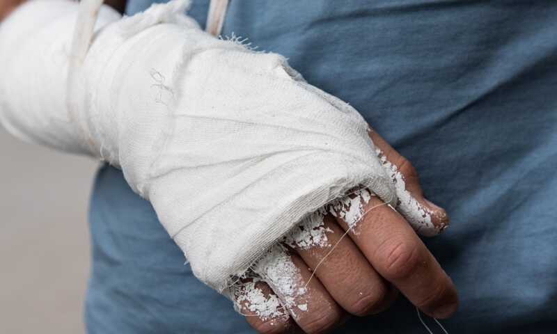 12-летнего мальчика из Пыть-Яха избили до сотрясения мозга и провалов в памяти