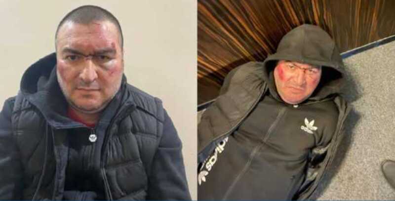 Силовики видят подделку медицинских документов, благодаря которым освободился "азербайджанский мститель" криминального авторитета из бильярдной Одессы