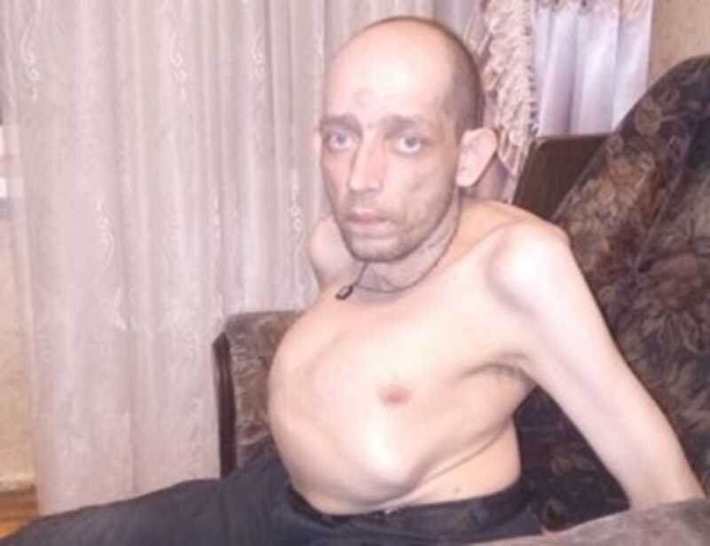 ФСИН вынес смертный приговор инвалиду I группы