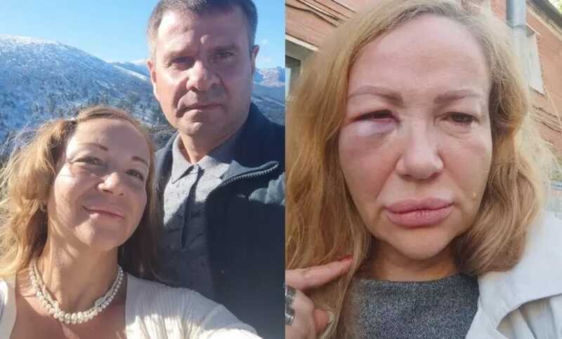 Российский депутат избил бывшую жену
