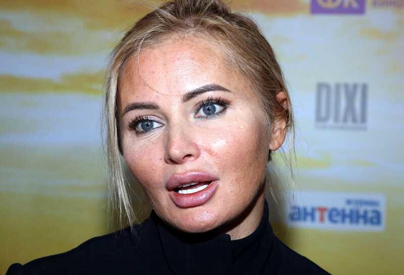 Дана Борисова подробно рассказала о лечении публично опозорившейся Глюкозы