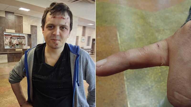 В Воронеже сотрудники силовых структур подвергли активистов пыткам из-за канала, посвященного репрессиям
